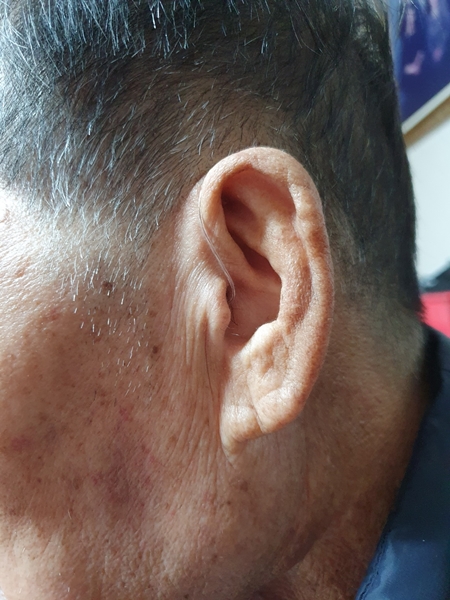 서울보청기 PC 이미지 1053274