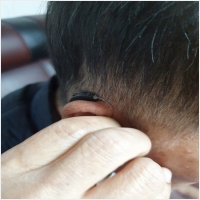 서울보청기 PC 갤러리 0