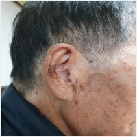 서울보청기 PC 갤러리 7